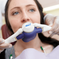 nitrous-oxide-happy-gas