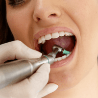 preventative-checkups-cleaning