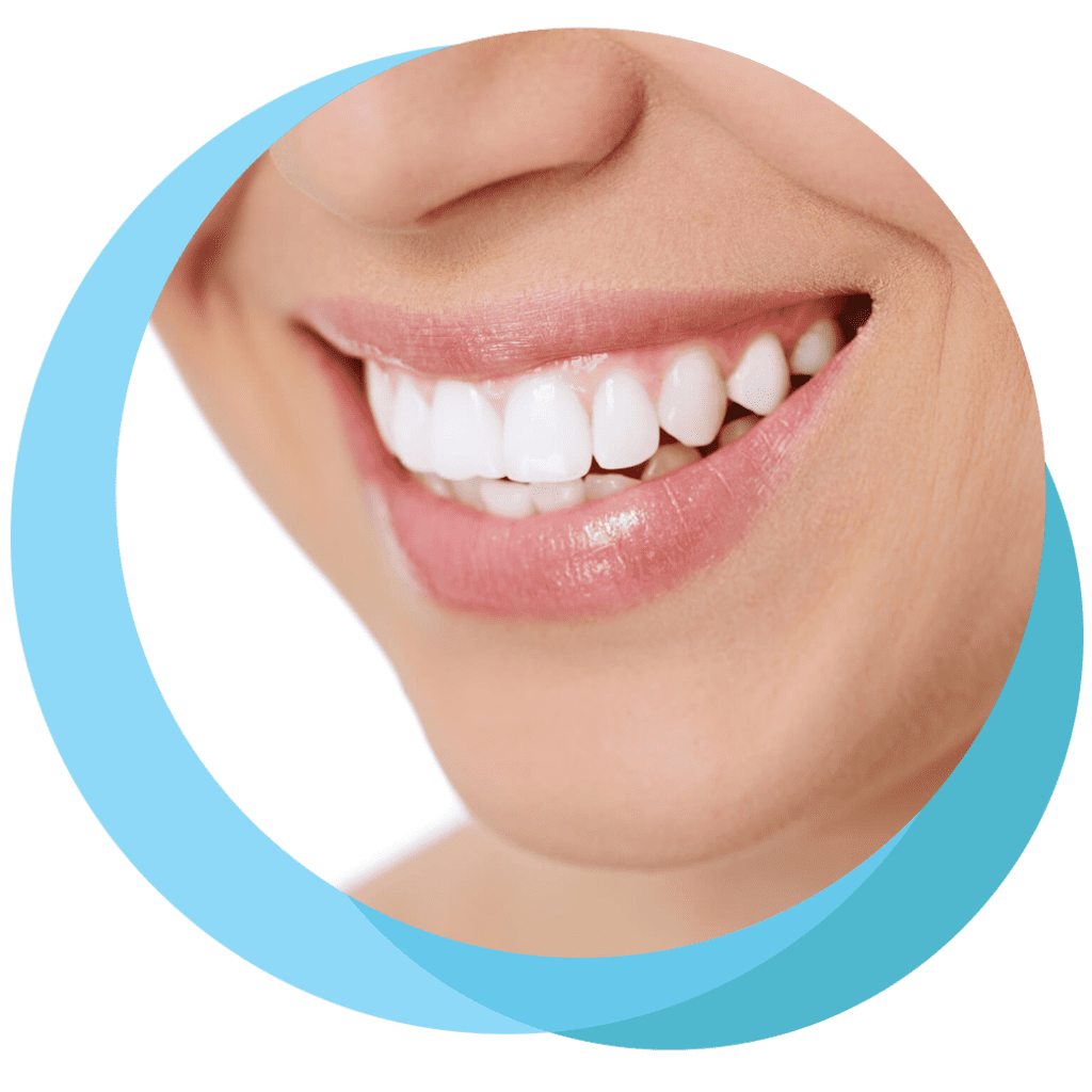 Teeth Whitening Canberra