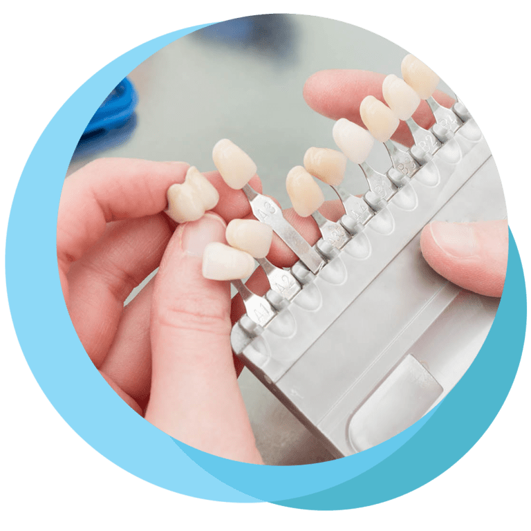 Same Day Crowns and Veneers Weston Dental Surgery