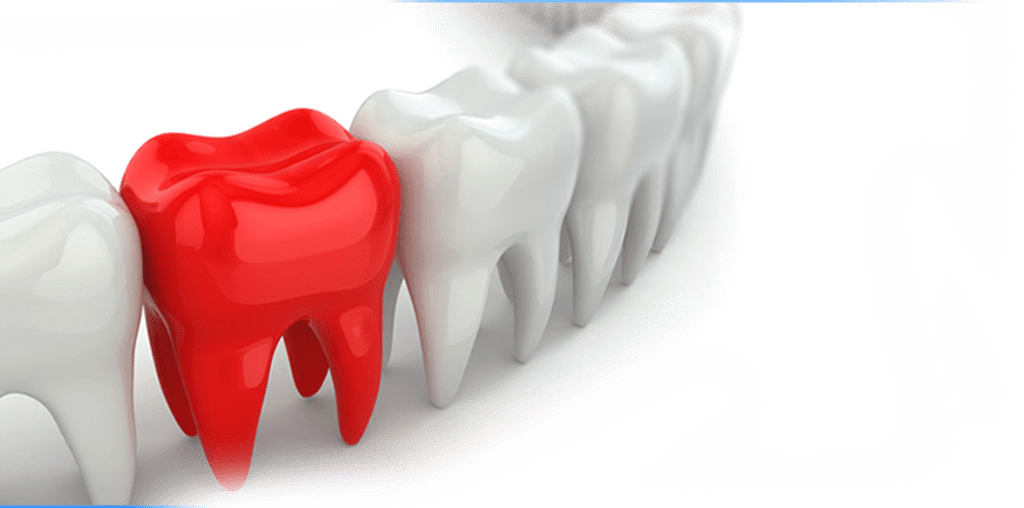 An infographic representing a mouth that received our cosmetic dentistry treatment in Canberra